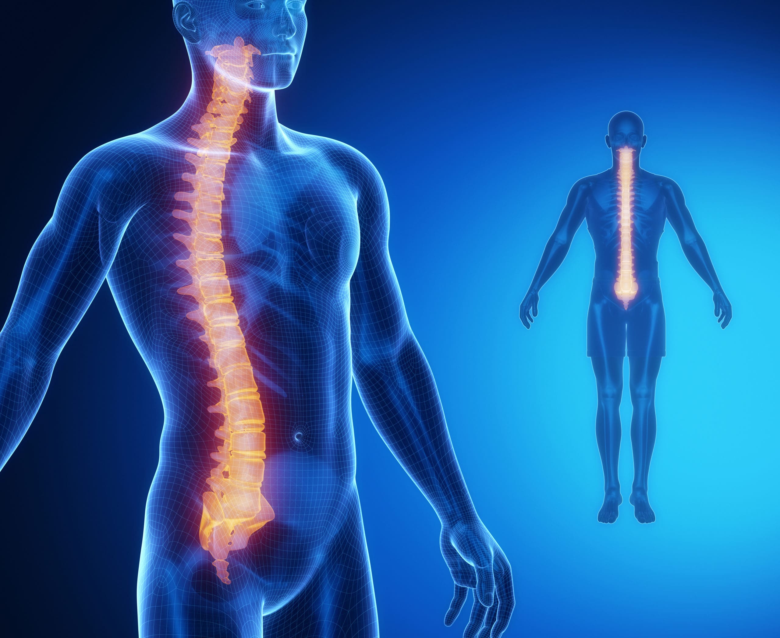 Spinal cord injuries, Serious injury Specialists.